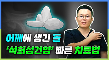 어깨 속 돌맹이 '석회성건염' 빠르게 낫는 법