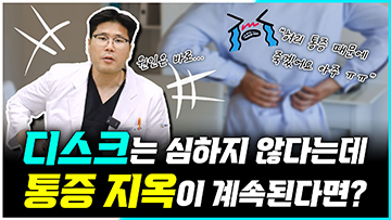 디스크는 심하지 않은데, 허리 통증 지옥이 계속된다면?
