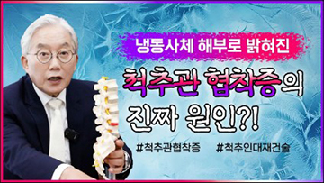 냉동사체 해부로 밝혀진, 척추관 협착증의 진짜 원인?!