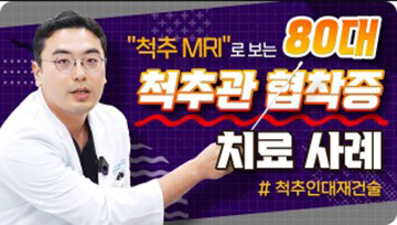 척추 MRI로 보는 '80대 척추관 협착증 치료사례'