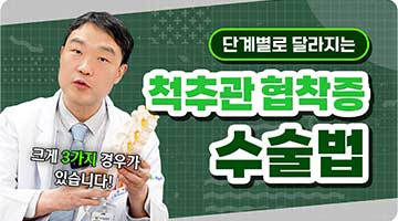 척추관협착증, 단계별 3가지 수술법 총정리